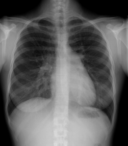 acpi 201304 pulmonology a1
